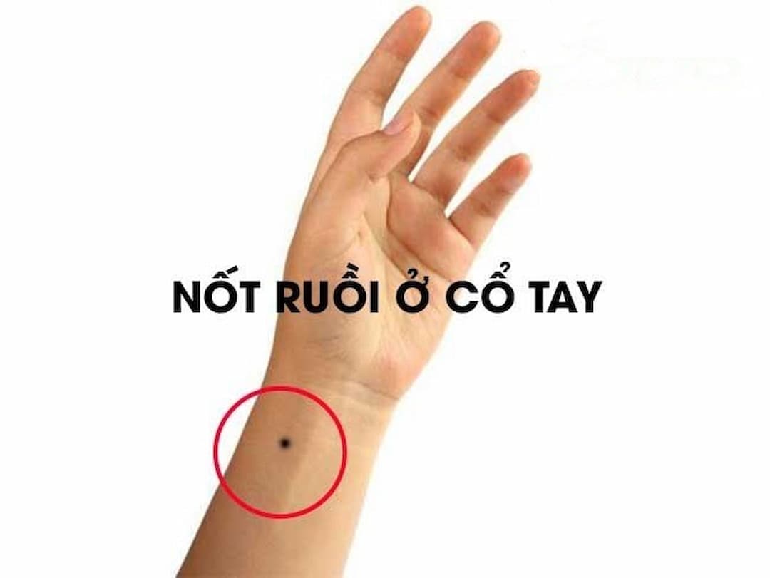 Ý nghĩa nốt ruồi gần cổ tay