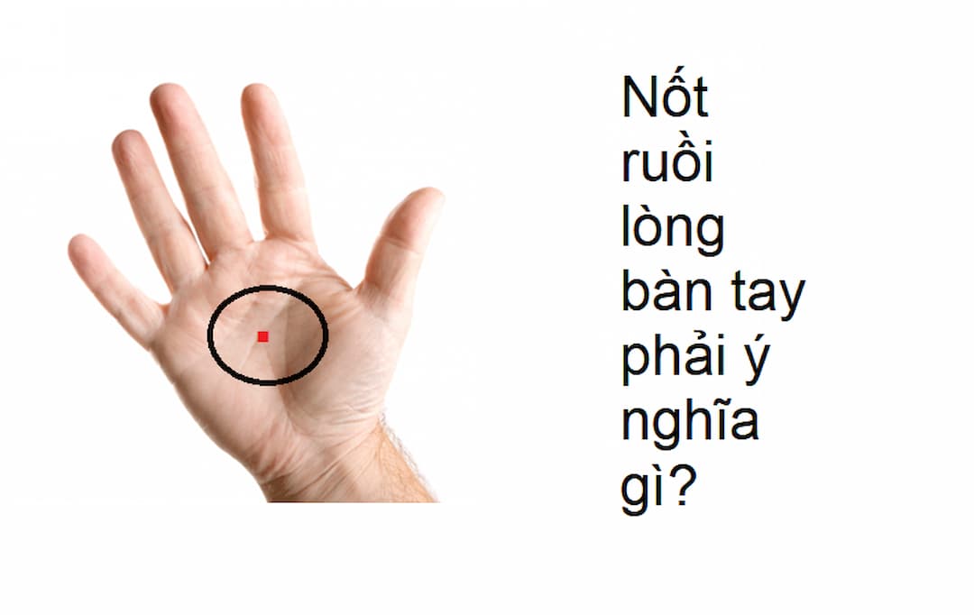 Nốt ruồi son ở tay mang lại ý nghĩa gì? Có may mắn không?