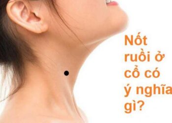 Tổng quan về nốt ruồi ở cổ