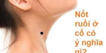 Tổng quan về nốt ruồi ở cổ