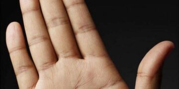 Xem bói theo ý nghĩa các nốt ruồi ở tay