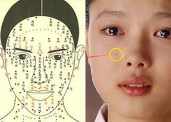 Nốt ruồi trên khuôn mặt mang nhiều tầng ý nghĩa 