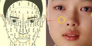 Nốt ruồi trên khuôn mặt mang nhiều tầng ý nghĩa 