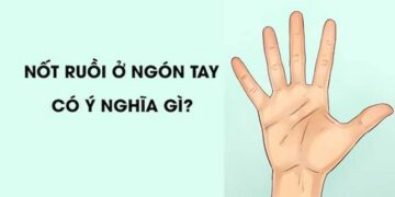 Nốt ruồi ở ngón tay có ý nghĩa gì?