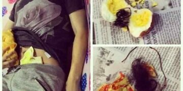 Chơi ngải bị quật