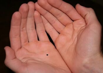 Giải mã ý nghĩa nốt ruồi ở lòng bàn tay nam và nữ chi tiết