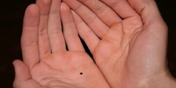 Giải mã ý nghĩa nốt ruồi ở lòng bàn tay nam và nữ chi tiết