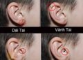 Bí mật nốt ruồi ở vành tai nam giới và nữ giới liệu bạn đã biết?