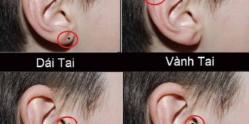 Bí mật nốt ruồi ở vành tai nam giới và nữ giới liệu bạn đã biết?
