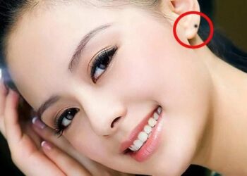 Nốt ruồi ở vành tai nữ bên phải bên trái nói lên điều gì