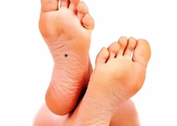 Nốt ruồi ở chân: giải mã về tình duyên, tài lộc, vận mệnh