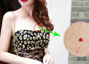 Nốt ruồi son ở ngực phụ nữ là giàu sang – Đào hoa ?
