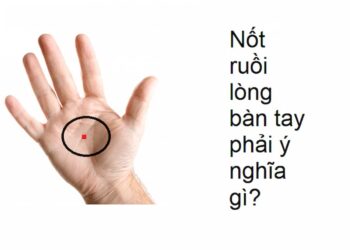 Nốt ruồi son ở tay mang lại ý nghĩa gì? Có may mắn không?