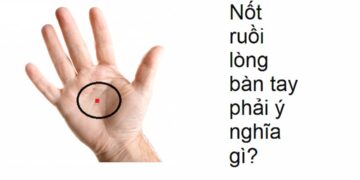 Nốt ruồi son ở tay mang lại ý nghĩa gì? Có may mắn không?