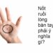 Nốt ruồi son ở tay mang lại ý nghĩa gì? Có may mắn không?