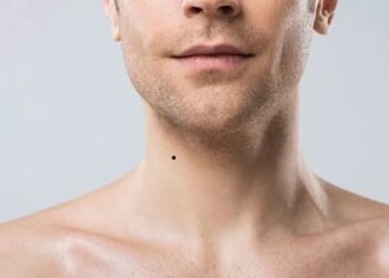 nốt ruồi ở cổ phải của nam