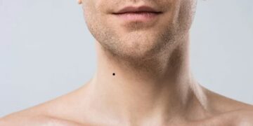 nốt ruồi ở cổ phải của nam