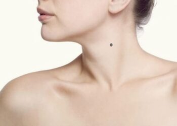 nốt ruồi ở cổ phải của nữ