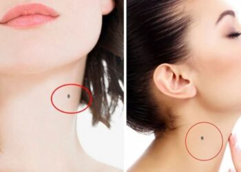 nốt ruồi ở cổ trái của nữ
