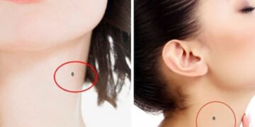 nốt ruồi ở cổ trái của nữ
